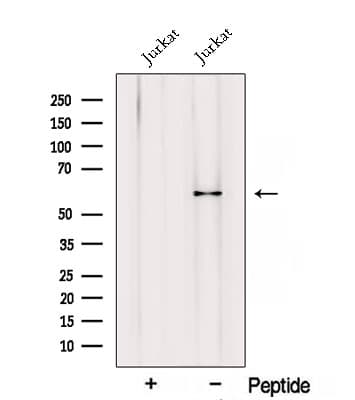 Polyclonal Rabbit anti-Human RIC8A Antibody (WB)