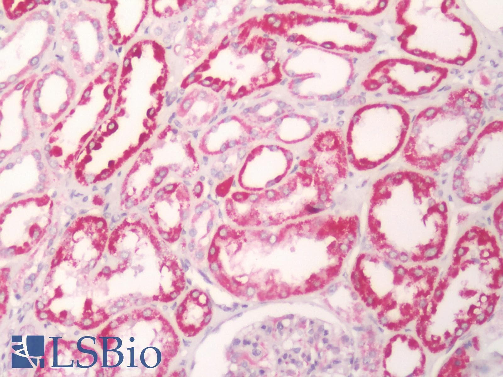 IHC-plus™ Polyclonal Rabbit anti-Human FKSG80 / GPR81 Antibody (Cytoplasmic Domain, IHC)