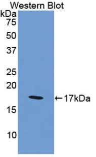 F8 / FVIII / Factor VIII Antibody (aa2253-2346)
