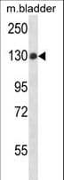 PTPN14 / PEZ Antibody (aa862-890)