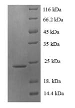 Chimpanzee Lymphotoxin-Beta / LTB Protein (Recombinant 6His-SUMO, N-terminus)