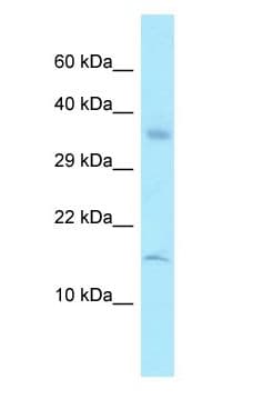 RPL36A / Ribosomal Protein L36 Antibody (aa56-105)