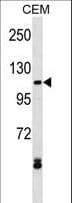 Polyclonal Rabbit anti-Human MECOM / EVI1 Antibody (aa1-30, WB)