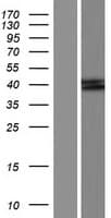 AMT Protein (Over-Expression Lysate Myc-DDK (Flag))
