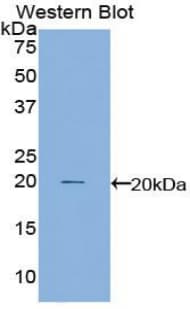 CTLA4 / CD152 Antibody (aa45-185, APC)