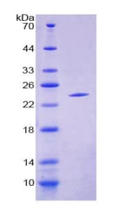 Human CRYAB / Alpha B Crystallin Protein (Recombinant His-T7)