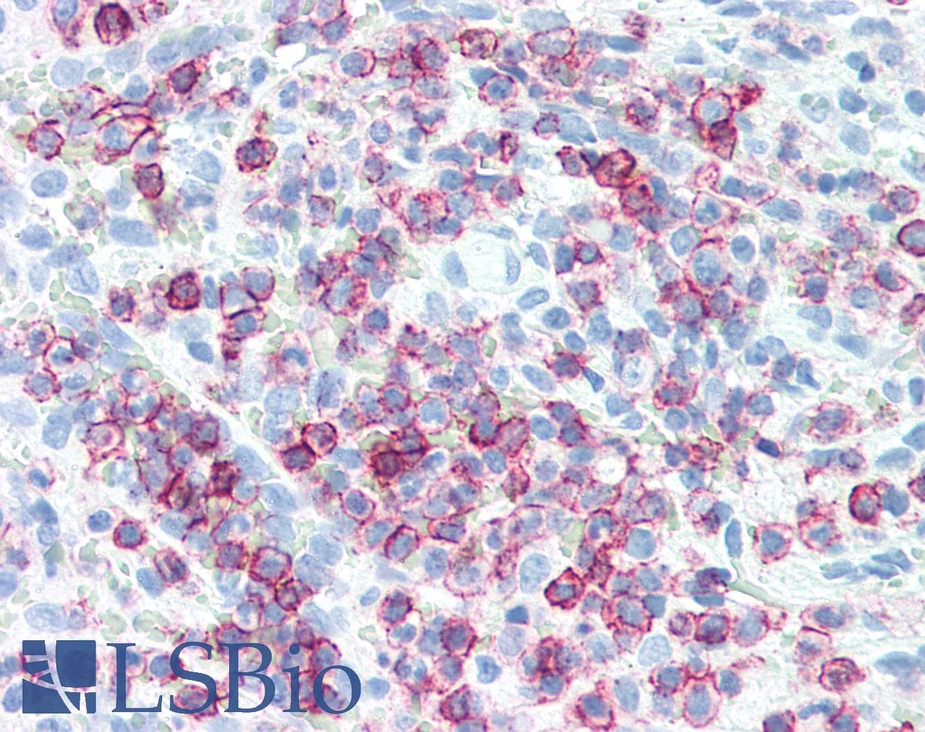 PathPlus™ SPN / CD43 Antibody