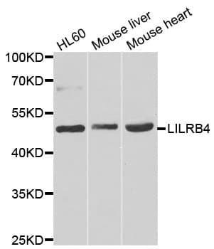 Polyclonal Rabbit anti-Human ILT3 / LILRB4 Antibody (IHC, WB)