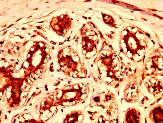 Polyclonal Rabbit anti-Human STAG3 Antibody (IHC)