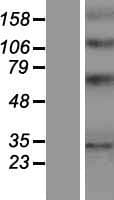YIPF1 Protein (Over-Expression Lysate Myc-DDK (Flag))