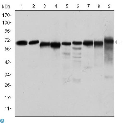 PRKAA1 / AMPK Alpha 1 Antibody