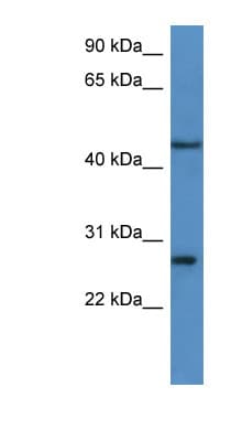 Polyclonal Rabbit anti-Human FGFBP2 Antibody (C-Terminus, WB)