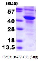 Human SULT2B1 / Sulfotransferase 2B1 Protein (Recombinant)
