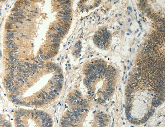 Polyclonal Rabbit anti-Human SOCS5 Antibody (IHC)