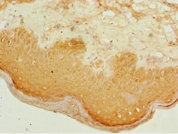 ATMIN Antibody