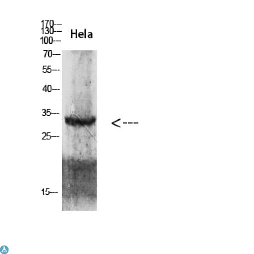Polyclonal Rabbit anti-Human CDK6 Antibody (IHC, WB)
