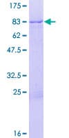 Human ZNF671 Protein (Recombinant GST)