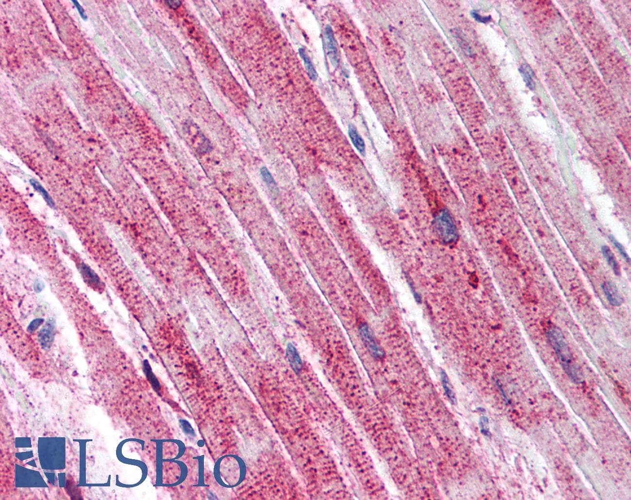 IHC-plus™ Polyclonal Rabbit anti-Human ADAMTS4 Antibody (Internal, IHC)