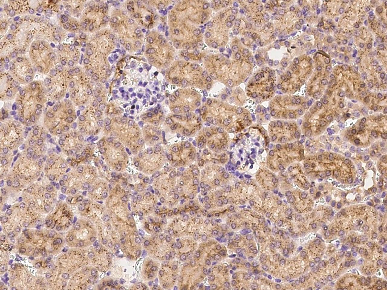 IL20RA Antibody (Preservative Free)