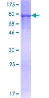 Human G6PD Protein (Recombinant GST)