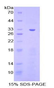 Mouse CHEK1 / CHK1 Protein (Recombinant His-T7)