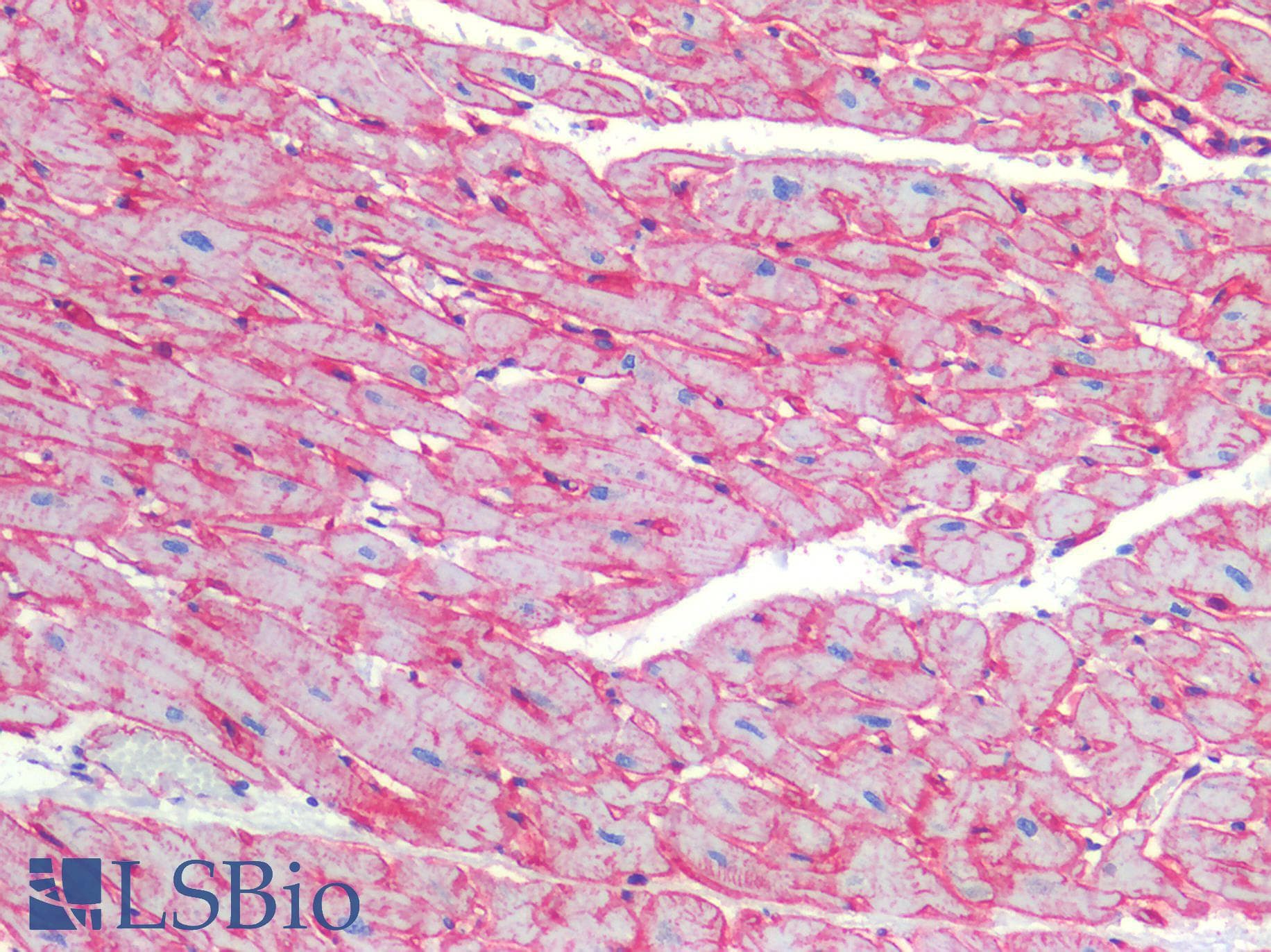 IHC-plus™ CAV1 / Caveolin 1 Antibody (C-Terminus)