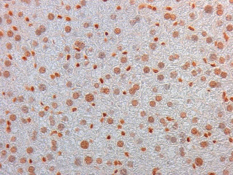 AKT3 Antibody (Internal, clone 25F6.F6.D8, RPE)