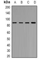 Polyclonal Rabbit anti-Human YTHDC1 Antibody (IF, WB)
