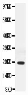 IFN Gamma / Interferon Gamma Antibody (aa23-156)