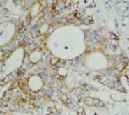 TNF Alpha Antibody (C-Terminus)
