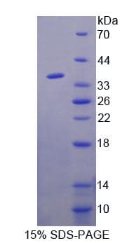 Human HIPK1 Protein (Recombinant His-T7)