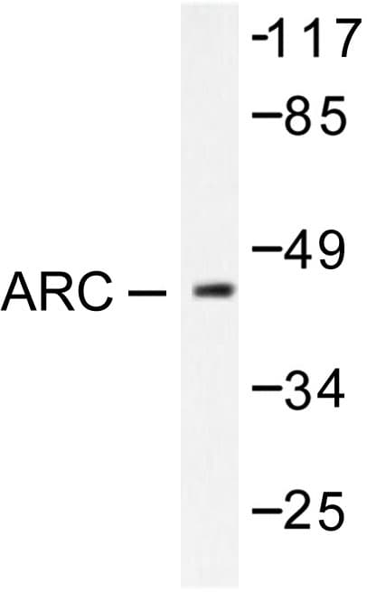 NOL3 / ARC Antibody (Glu194)