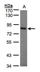 RPS6KA1 / RSK1 Antibody (aa303-527)