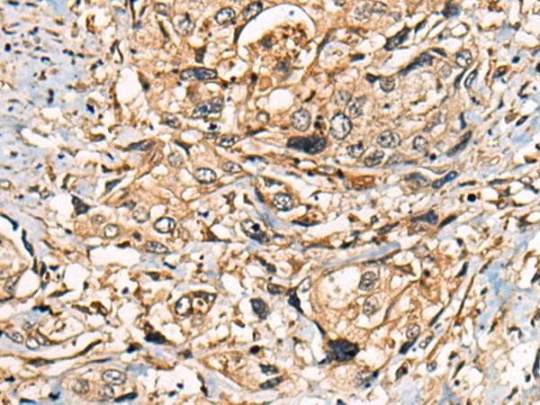 PIBF1 / PIBF Antibody