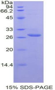 Mouse TIGIT Protein (Recombinant His-T7)
