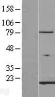 FABP3 / H-FABP Protein (Over-Expression Lysate Myc-DDK (Flag))