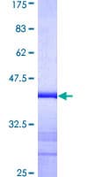 Human Alpha-Fetoprotein (Recombinant GST, N-terminus)