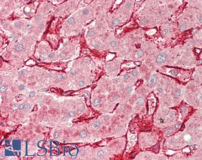 IHC-plus™ AOC3 / VAP-1 Antibody
