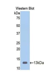 GC / Vitamin D-Binding Protein Antibody (aa395-475)