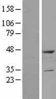 CTDNEP1 / DULLARD Protein (Over-Expression Lysate Myc-DDK (Flag))