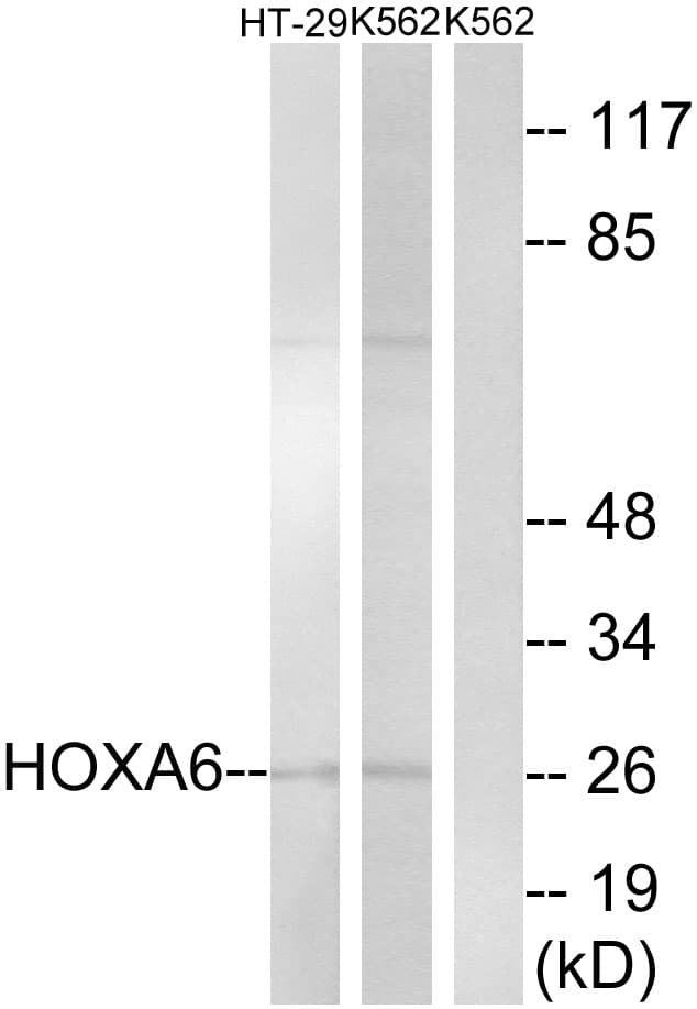 HOXA6 Antibody (aa101-150)