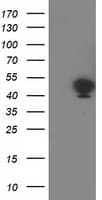TMOD1 / Tropomodulin 1 Antibody (clone OTI5F8)