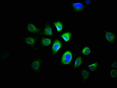 Polyclonal Rabbit anti-Human PRMT1 Antibody (IHC, WB)