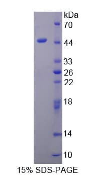 Human PPM1A / PP2CA Protein (Recombinant His-T7)