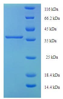 Human CYGB / Cytoglobin Protein (Recombinant His-SUMO)