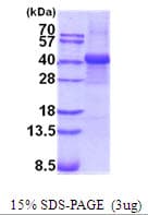 Human FGB / Fibrinogen Beta Chain Protein (Recombinant His)