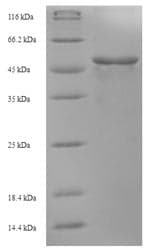 Bacillus subtilis fabF / 3-Oxoacyl-Synthase 2 Protein (Recombinant 6His, N-terminus)