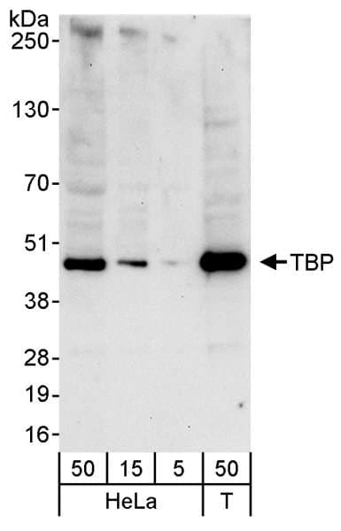 Polyclonal Rabbit anti-Human TBP / GTF2D Antibody (aa1-50, WB)