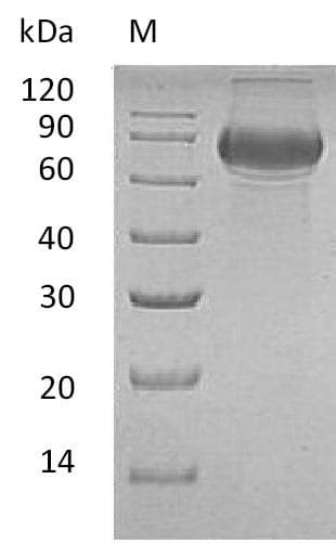 Human CD19 Protein (Recombinant Fc, C-terminus)