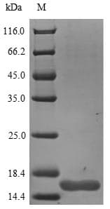 Rat NGF Protein (Recombinant 6His, N-terminus)